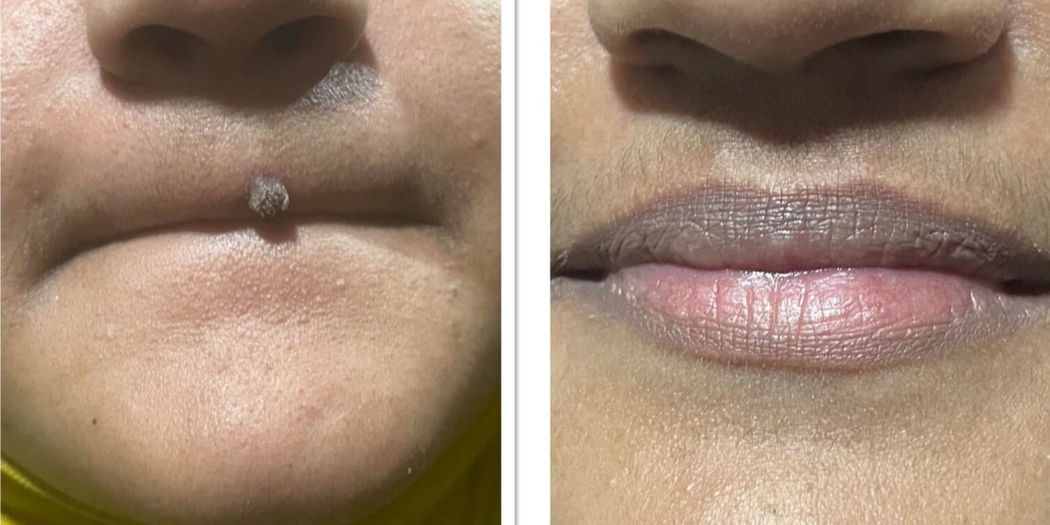 Before and After Image