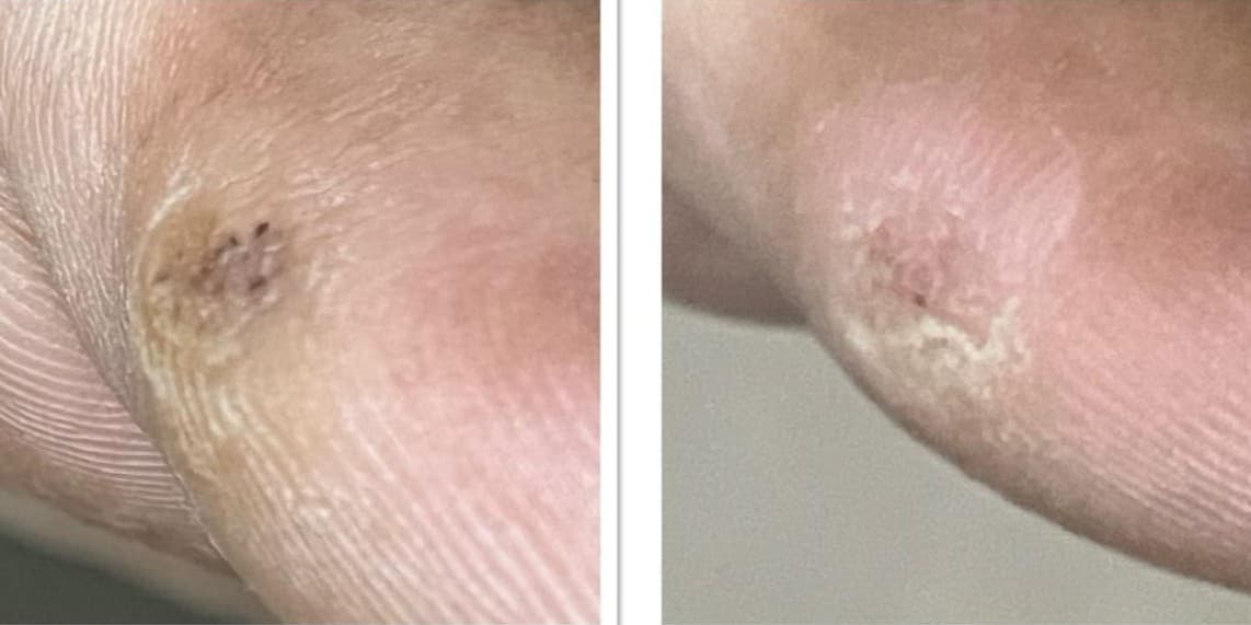 Before and After Image