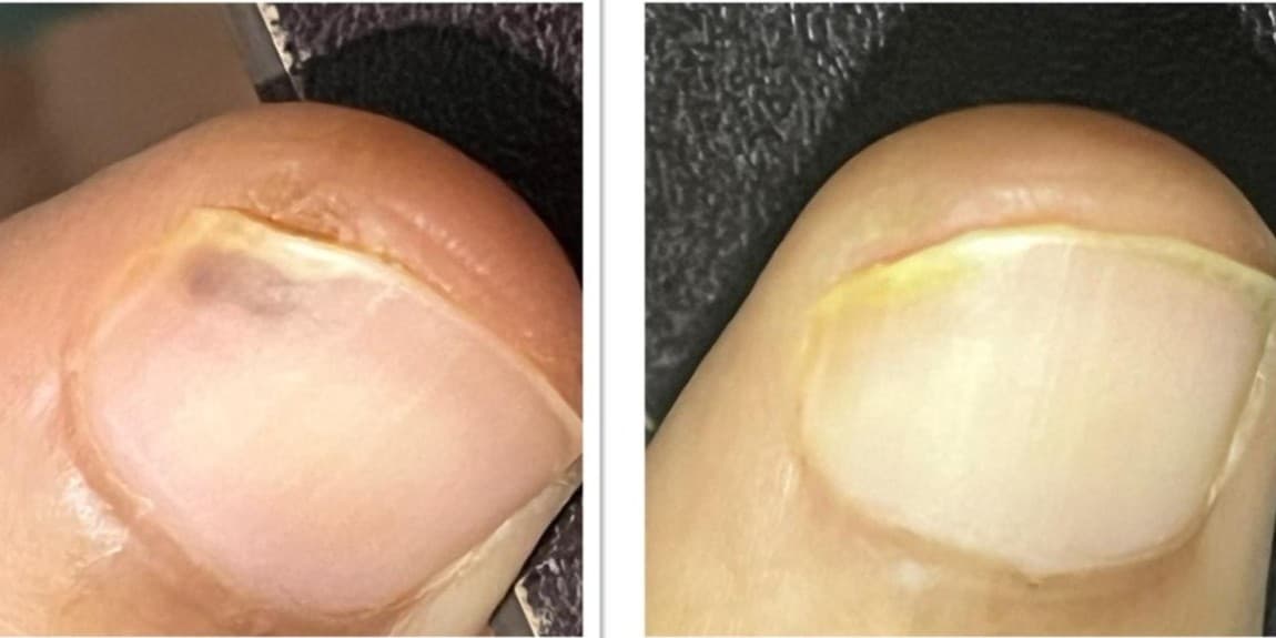 Before and After Image