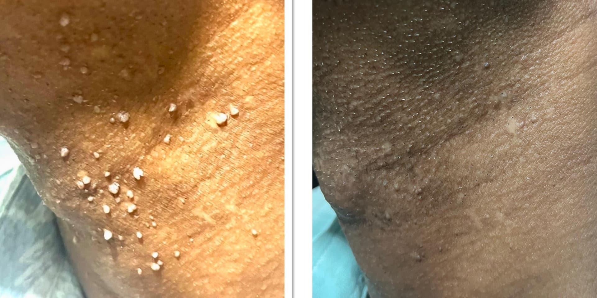 Before and After Image