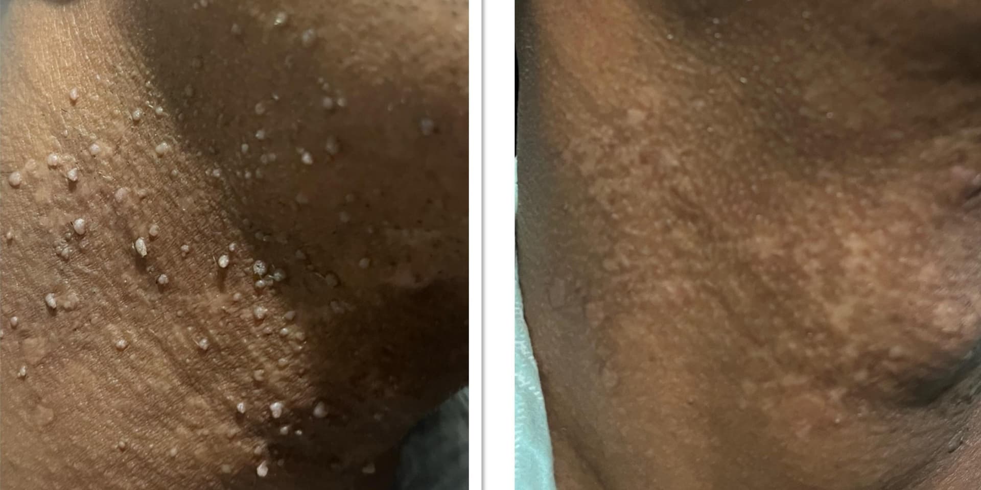 Before and After Image