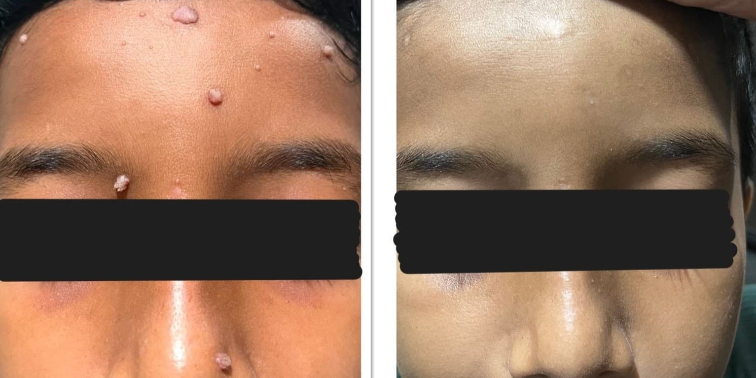 Before and After Image