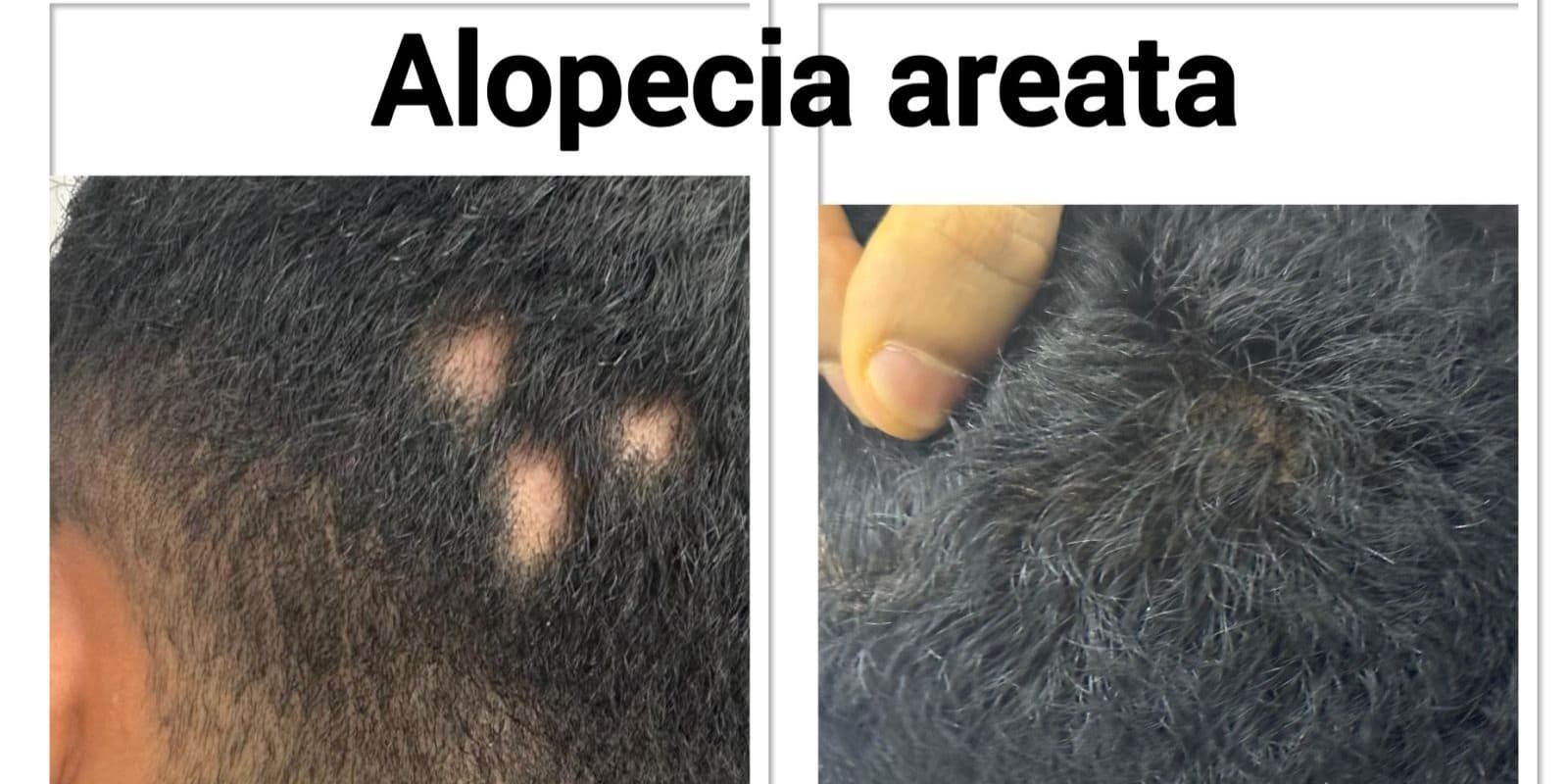 Before and After Image